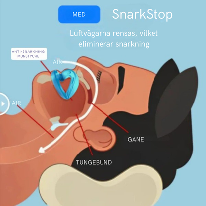SnarkStöp™-TystNatt |Fri luftväg och tystare nätter