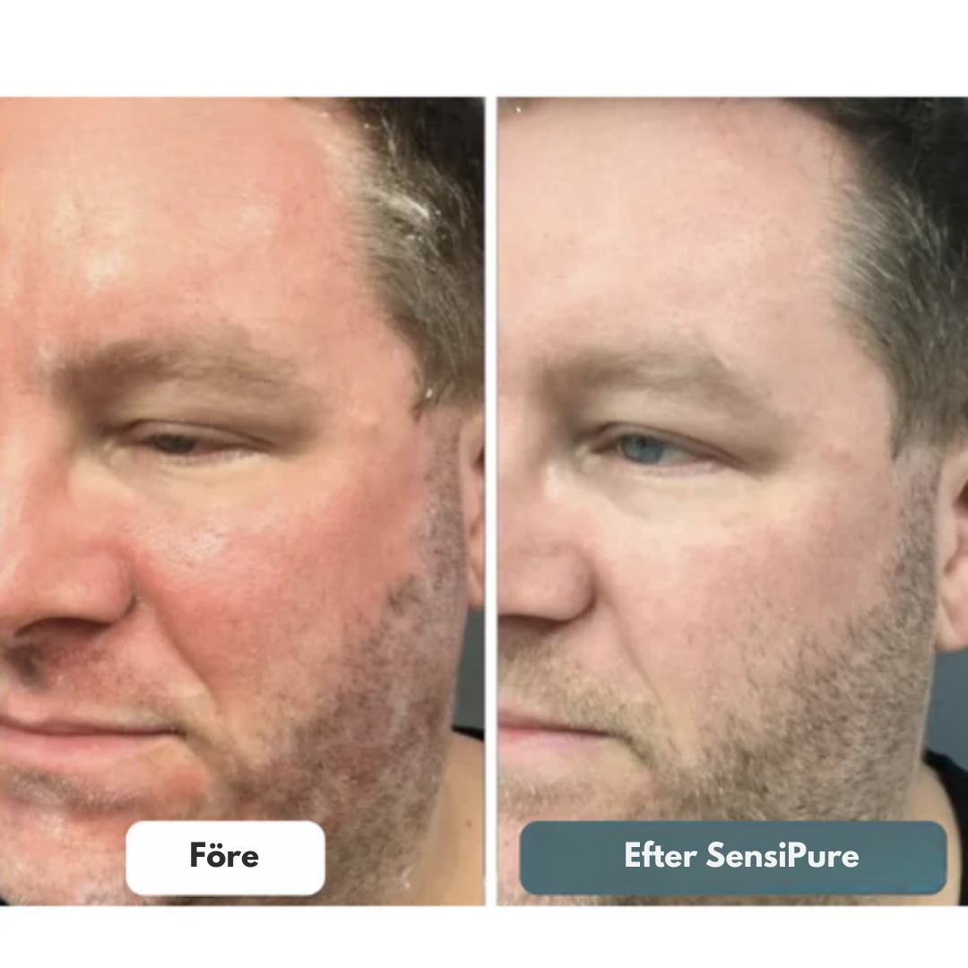 SensiPure™ Advanced Kräm