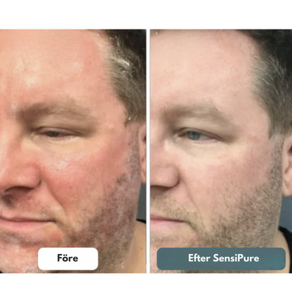 SensiPure™ Advanced Kräm